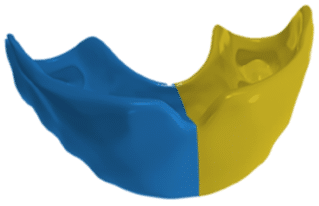 Monarch Mouthguard | ArchformByte Ltd